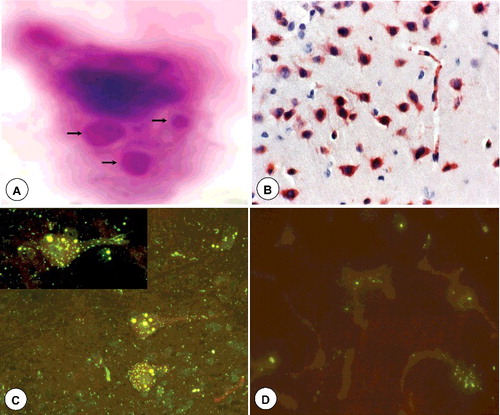 Figure 2. Diagnostic techniques for rabies. (A) Brain impression smear showing oval or round magenta coloured Negri bodies (arrow) in the cytoplasm of neuron. Seller's stain x1000. (B) Intense brown colour signals of rabies virus antigen in the cytoplasm of pyramidal neurons in experimentally infected mice brain with challenge virus standard (CVS) strain of rabies virus. IHC-DAB-MH x200. (C) Brain impression smear showing bright apple green dusty fluorescent signals of rabies virus antigen in the cytoplasm of neurons in a spotted deer. Inset showing plenty of specific signals in the cytoplasmic processes and stroma of neuron. dFAT x200. (D). Bright apple green fluorescent signals of rabies virus antigen in the smear of saliva in a dog. dFAT x200.