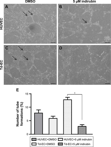 Figure 4 Effects of indirubin on Td-EC tube formation in vitro.