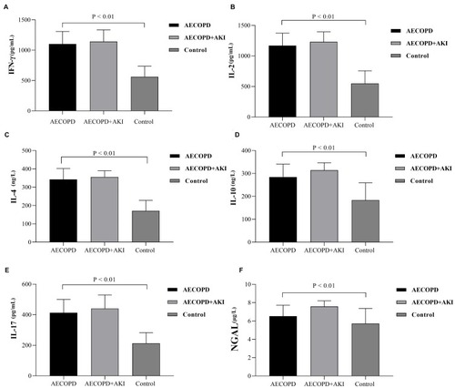 Figure 1 The expression levels of inflammatory factors in AECOPD group, AECOPD with AKI group, and control group. (A) IFN-γ; (B) IL-2; (C) IL-4; (D) IL-10; (E) IL-17; (F) NGAL.