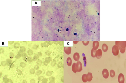 Figure 1 Photographs of P. falciparum (X 100) (A) Thick blood film showing ring stages of the parasite. (B) Thin blood film showing red blood cells containing ring stages. (C) Thin blood film showing gametocyte stage.