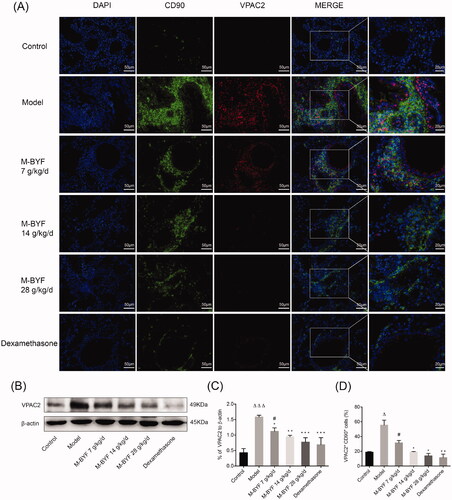 Figure 9. Effects of M-BYF on VPAC2 expression and VPAC2+CD90+ cells in OVA-induced asthmatic mice. (A) Representative immunofluorescent staining images of VPAC2 and VPAC2+CD90+ cells. VPAC2 staining as shown in red. CD90 staining as shown in green. Scale bar: 50 µm and 20 µm. (B, C) The protein expression of VPAC2 in lungs was detected by western blot and densitometric analysis was performed. M-BYF reduced the expression of VPAC2 protein in lungs of asthmatic mice as compared with the Model group (D) Quantification of VPAC2+CD90+ cells showed that M-BYF reduced percentage of VPAC2+CD90+ cells in lungs of asthmatic mice as compared with the Model group. Four non-consecutive sections from each animal were averaged and compared among experimental groups; n = 3 in each group. Data are represented as mean ± S.E.M. (ΔΔΔp < 0.001, Δp < 0.05 compared with the Control group; ***p < 0.001, **p < 0.01 and *p < 0.05 compared with the Model group; #p < 0.05 compared with the dexamethasone treated group.)