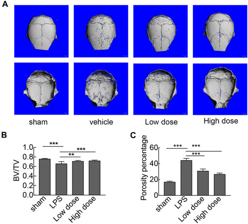 Figure 4 Sarsasapogenin protects against LPS-induced bone loss in vivo. (A) Micro-CT scanning and 3D reconstruction of the entire caldaria of mice from the sham (PBS), LPS (5 mg LPS/kg body weight), low-dose sarsasapogenin (5 mg LPS/kg and 5 mg sarsasapogenin/kg), and high-dose sarsasapogenin (5 mg LPS/kg and 10 mg sarsasapogenin/kg) groups (n = 6). Scale bar = 1 mm. (B) Quantitative analysis of BV/TV (n = 6). (C) Percentage porosity (n = 6). Data represent the mean ± SD; **p < 0.01 and ***p < 0.001 versus respective controls.