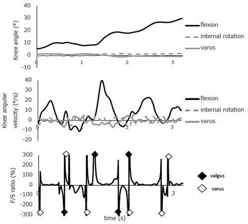 Figure 4e. Knee biomechanics during a slow, single-leg squat from 0° to 30° knee flexion in subject 5. Quantitative analysis of the F/S spikes detected a lot of KW during the entire descent. This case presented an obvious moment with decreasing knee flexion movement