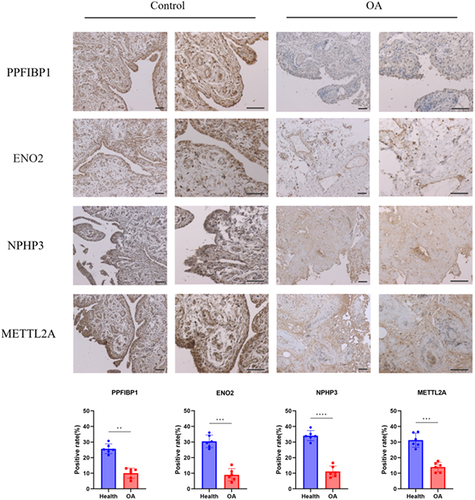 Figure 10 Typical IHC graphics of signature genes staining in synovium.