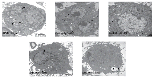 Figure 3. Morphology of DCs treated with RGMa-neutralizing antibodies under TEM. Morphology was determined after 10 μg/ml antibody treatment for 48 h. In the RPMI 1640, Anti-RGMa/ABP and Anti-RGMa/LPS groups, DCs displayed more pinocytotic vesicles (thick solid arrow) and lysosomes (fine line arrow); in the Control-IgG/ABP and Control-IgG/LPS groups, DCs showed multiple organelles, such as mitochondria (single-dashed line arrow) and Golgi apparatus (double-dashed line arrow). Magnification ×10,000