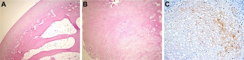 Figure 3 Histopathological appearance of cartilage formed in the CS group.