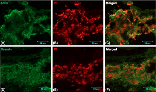 Figure 5. Rat skeletal myoblasts (cell line) were seeded on the collagen nanofibrous scaffold and cultured for 6 days, cryosectioned, and stained. Collagen matrices showed prominent cell adherence and proliferation throughout when examined by immunofluorescence staining using confocal microscopy. A. anti- muscle-specific actin FITC, B. Nuclear staining with propidium iodide, and C. Merged image, D. anti-desmin FITC, E. nuclear staining with propidium iodide, and F. merged image. Scale bar = 50 μm.