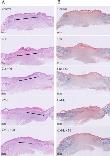 Figure 12 Histopathological results of wound sites on day 8 treated with curcumin-loaded micelle formulations and microcurrent cloth. The length of the arrow indicates the length of the dermal gap. (A) H&E staining. (B) Masson’s trichrome staining. (magnifications 2x, bar = 500 μm).