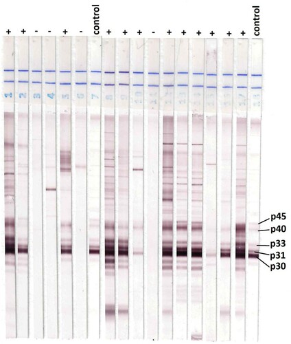Figure 3. Western blot results of samples from Rabat. The comparison of additional bands (P31, P33, P40, P45, and particularly P30) on the strip of IgG indicates infection with Toxoplasma.