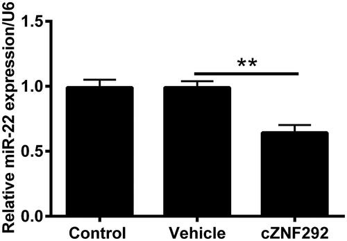Figure 4. Effect of cZNF292 on miR-22 in NSCs. When NSCs were transfected by cZNF292, the level of miR-22 was determined by qRT-PCR. MiR-22 was negatively regulated by cZNF292. **p < .01 compared to labelled groups.