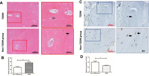 Figure 2 Hematoxylin and eosin staining and immunohistochemical detection of Cx43 expression in cortical bone samples from patients with femoral neck fractures. (A) Hematoxylin and eosin staining. Only osteocytes in cortical bone were calculated. One section with the best cortical bone condition was selected for each patient, and three fields of cortical bone were imaged in each slice. The ratio of empty bone lacuna to total lacuna was calculated. There was a higher empty osteocyte lacunae rate (54.93%) in the T2DM group than the non-T2DM group (36.51%). (B) The statistical analysis is shown in the histogram. *P<0.05 vs non-T2DM. Data are presented as the mean ± standard deviation of three independent experiments. Bar = 100 μm (original magnification 200×). White and black arrows indicate empty and normal bone lacunae, respectively. (C) Immunohistochemical results showed that Cx43 expression was reduced by 35.67% in patients with T2DM compared with the non-T2DM group. (D) The statistical analysis is shown in the histogram. *P<0.05 vs non-T2DM. Data are presented as the mean ± standard deviation of three independent experiments. Bar = 50 μm (original magnification 400×). White and black arrows indicate the empty and normal bone lacunae, respectively.