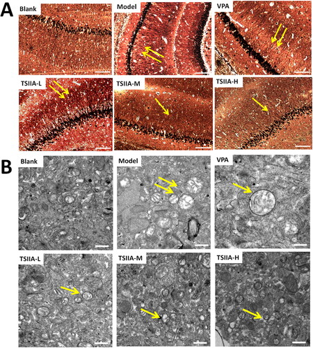 Figure 4. Effects of tanshinone IIA on mossy fibre sprouting (MFS) and ultrastructure deterioration in the hippocampus. (A) Timm staining was utilized to evaluate the effects of tanshinone IIA on MFS (×200, scale bar: 100 μm). Seizures increased granules in the stratum pyramidal or stratum oriens of the CA3 region, as indicated by the yellow arrows, with the number of arrows indicating the granule increase. Massive MFS induced by LiCl–pilocarpine was mitigated by tanshinone IIA treatment. (B) Transmission electron microscopy was utilized to assess ultrastructure damage (×20,000, scale bar: 0.5 μm). As indicated by the yellow arrows, seizures increased vacuolar degeneration in the CA3 region, and the number of arrows reflected the quantity and degree of vacuolar degeneration. The treatment with tanshinone IIA enhanced the ultrastructural disorder and vacuolar degeneration (n = 6 per group).