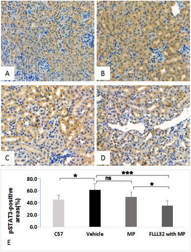 Figure 4. Representative images of pSTAT3 expression in renal tissue (immunochemistry staining, ×200) A. pSTAT3 expression in C57 mice; B, pSTAT3 expression in MRL/lpr mice treated with vehicle group; C, pSTAT3 expression of MRL/lpr mice treated with MP; D, pSTAT3 expression of MRL/lpr mice treated with FLLL32 with MP; E, Quantification analysis of pSTAT3-positive areas among four groups.