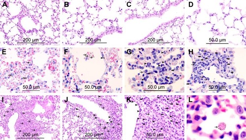 Figure 1 Representative histological lung sections obtained 24 hours after intratracheal instillation of either saline or 0.1 or 0.5 mg/kg cerium oxide nanoparticles (CeO2 NPs) in mice. (A–D) Are representative sections of control lungs. (A–D) Show normal lung tissue with unremarkable changes. (E–H) Are representative sections of lungs exposed to 0.1 mg/kg CeO2 NPs. (E) Shows the presence of CeO2 NPs within alveolar macrophages (thin arrows). (F) Shows the presence CeO2 NPs within alveolar space (thin arrow) and within the alveolar interstitial space (arrow head) associated with focal damage to the alveolar wall. (G) Shows the expansion of the alveolar interstitial space with neutrophil polymorphs (arrow head) and macrophages (thick arrow). CeO2 NPs are seen within alveolar macrophages (thin arrow). (H) Shows the expansion of the alveolar interstitial space with neutrophil polymorphs (thin arrow) and macrophages (thick arrow). (I–L) Are representative sections of lungs exposed to 0.5 mg/kg CeO2 NPs. (I) Shows severe expansion of the alveolar interstitial space with neutrophil polymorphs (thin arrow). (J) Shows severe expansion of the alveolar interstitial space with neutrophil polymorphs (arrow head) and macrophages (thin arrow). (K) Shows severe expansion of the alveolar interstitial space with neutrophil polymorphs (arrow head) and macrophages (thick arrow). CeO2 NPs are seen within a macrophage (thin arrow). (L) CeO2 NPs are seen within an alveolar macrophage (thin arrow). The scale bar on images A–C, I, and J is 200 μm. The scale bar on images D–H, and K is 50 μm.