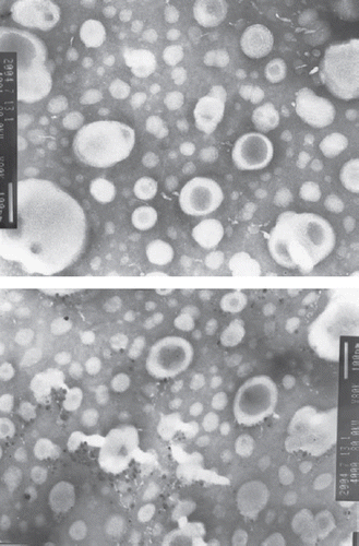 Figure 2. SEM pictures of timozolomide liposomes (×200,000).