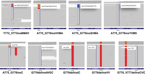 Figure 2 The Integrative Genomics Viewer screenshots displayed the reads of rare and novel 20ins subtypes identified by NGS.