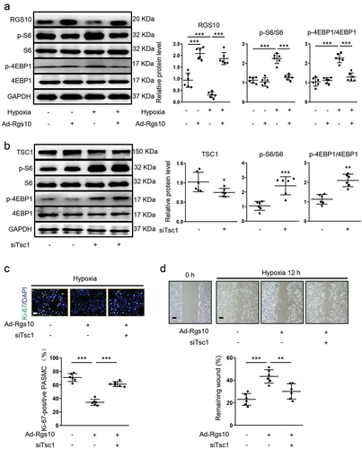 Figure 2. RGS10 inhibits hypoxia-induced proliferation and migration of PASMC via reducing mTORC1 activity. PASMC was transfected with Ad-Con or Ad-Rgs10 and then received normoxia or hypoxia stimulus. (a) the relative expression of RGS10, p-S6/S6 and p-4EBP1/4EBP1 in above-treated PASMC was analyzed by immunoblotting (post hoc for LSD test; n = 6 samples per group). (b) the relative expression of TSC1, p-S6/S6 and p-4EBP1/4EBP1 in PASMC incubated with scramble siRNA or siTsc1 were analyzed by immunoblotting (n = 6 samples per group). PASMC was transfected with Ad-Con or Ad-Rgs10 and then incubated with scramble siRNA or siTsc1 before receiving hypoxia stimulus. (c) above-treated PASMC was stained with Ki-67 (green) and DAPI (blue). Representative images (upper panel) and corresponding quantification of Ki-67-positive PASMC (lower panel) were shown (post hoc for LSD test; n = 6 samples per group). Bar = 50 μm. (d) migration of above-treated PASMC was analyzed by wound healing assay. (post hoc for LSD test; n = 6 samples per group). Bar = 200 μm. Data are shown as mean ± S.D. **P < .01 and ***P < .001 denote statistical comparison between the two marked groups, respectively.