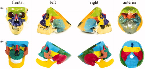 Figure 12. Photos of the cadaveric skull and 3D printed skull. a) Cadaveric skull is shown in frontal, left, right and anterior views, respectively. b) The 3D printed skull is shown in frontal, left, right and anterior views, respectively.