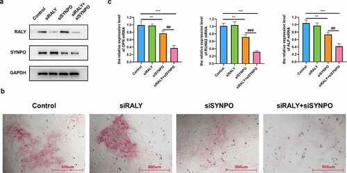 Figure 6. RALY and SYNPO regulate the osteogenic differentiation of hBMSCs. (a) The expression of RALY and SYNPO was detected by Western blot. (b) The osteogenic differentiation ability was detected by ARS staining assay. (c) The relative expression of osteogenic marker genes (OPN, RUNX2, and ALP) mRNA was detected by qRT-PCR. Compared with the control group, **P < 0.01, ***P < 0.001; Compared with the siSYNPO group, ##P < 0.01, ###P < 0.001