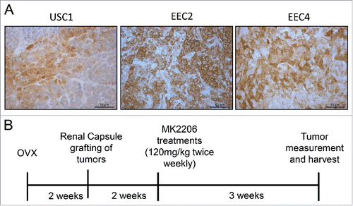 Figure 1. Phospho (Ser473)-AKT levels in endometrial PDX tumors and experimental design. (A) PDX tumors from 3 cases were stained for p(Ser473)-AKT by immunohistochemistry. (B) Schematic of experiment for treatment of PDX lines with MK2206 is shown.