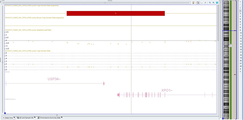 Figure 7 Patient’s chromosomal microarray results showing a deletion covering XPO1 and USP34 genes (Chromosome Analysis Suite (Chas) Software).