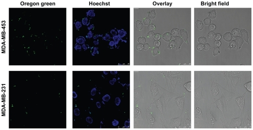 Figure 3 Confocal microscopy of uptake of transfection-competent complexes into MDA-MB-453 versus MDA-MB-231 cells. Confocal microscope analysis of uptake of Oregon green labeled-DNA:Her-NLS fusion protein complexes into cells. Peptide-mediated uptake of labeled DNA into MDA-MB-453 and MDA-MB-231 is seen as cell-associated fluorescence. DNA 0.9 μg was used to make the transfection complexes at a charge ratio of 1:8:2 (DNA:peptide:protamine sulfate) and applied to cells in the absence of serum. Uptake of the complexes is for three hours’ duration, after which the cells were counterstained with Hoechst 33258, and visualized by confocal microscopy as described.Abbreviation: NLS, nuclear localization sequence.