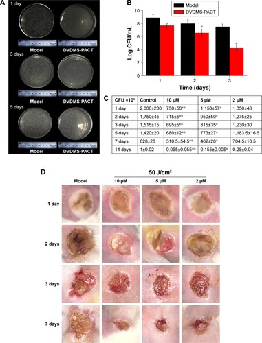 Figure 9 CFU assay of Staphylococcus aureus and MDR S. aureus of skin tissue at different times.Notes: (A) Representative bacterial colonies on trypticase soy agar are shown. (B) MDR S. aureus CFU counts in PACT treatment and the model group (without any treatment) were assessed with 20 μM DVDMS at different times. (C) Bacteria counts of S. aureus with 10 μM DVDMS treatment at different times. Data expressed as means ± SD of three independent experiments. *P<0.05; **P<0.01. (D) Wound observation at different times after PACT treatment.Abbreviations: DVDMS, sinoporphyrin sodium; MDR, multidrug-resistant; PACT, photodynamic antimicrobial chemotherapy.