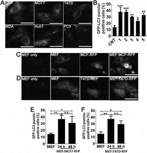 Figure 1. Cancer cell-derived factors triggered autophagy in the neighboring fibroblasts. (a and b) Treatment of fibroblast cells with conditioned culture media from MCF7 (1), T47D (2), MDA-MB-231 (MDA; 3), Huh7 (4), and PC3 (5) cancer cells increased GFP-LC3 puncta formation in fibroblast cells. CNT, conditioned medium from MEF cells alone. Quantitative analysis of GFP-LC3 positivity was shown in graphs (mean ± SD of independent experiments, n = 3, *: p < 0.05, **: p < 0.01, ***: p < 0.001) (c) Co-culture of RFP-positive MCF7 (MCF7-RFP) breast cancer cells with GFP-LC3 MEF (MEF) cells. (e) Quantitative analysis of GFP-LC3 positivity in MEF:MCF7-RFP co-culture experiments (24 h and 48 h) (mean ± SD of independent experiments, n = 3, *: p < 0.05; **: p < 0.01). MEF, GFP-LC3 fibroblasts alone (48 h). (d) Co-culture of RFP-positive T47D (T47D-RFP) breast cancer cells with GFP-LC3 MEF (MEF) cells. (f) Quantitative analysis of GFP-LC3 positivity in MEF:T47D-RFP co-culture experiments (24 h and 48 h) (mean ± SD of independent experiments, n = 3, *: p < 0.05; **: p < 0.01). MEF, GFP-LC3 fibroblast alone (48 h). Scale bar: 20 µm.