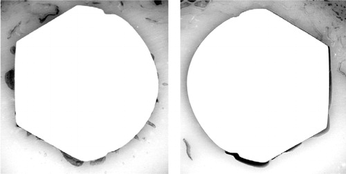 Figure 5. Reflected light images of a typical pair of sections showing the difference in stem-cement interface non-apposition between Simplex (left) and CMW3 (right).Although stem-cement gaps were of similar cross-sectional area, a larger fraction of the stem perimeter was compromised in the case of CMW3.Note that the morphologies of these gaps suggested that they were produced by polymerization shrinkage rather than by mechanical loading.If stem-cement gaps had been caused by loading, one would expect a gradual divergence of stem and cement rather than the abrupt changes between apposed and non-apposed regions that were found.