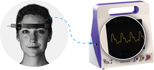 Figure 2 Band connected to Brain4care's non-invasive ICP measuring device.