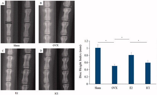 Figure 2. The radiographs were used to measure DHI. On the left is a anteroposterior film and right is lateral film. The average intervertebral disc height of Co5/Co6, Co6/Co7 and Co7/Co8 was defined as DHI. Forty, three-month-old female Sprague Dawley rats were randomly divided into four groups: Sham, OVX, E2 and ICI. Sham group only underwent the resection of a bit of fat; OVX group underwent bilateral ovariectomy; E2 group was treated with 17β-Estradiol based on OVX and ICI group was treated with 17β-Estradiol and were also pretreated with ICI182780 (inhibitor of the estrogen receptor) based on OVX (Mean ± SD; n = 10). DHI: Disc Height Index; E2: 17β-Estradiol. *p < .05.