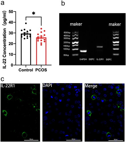 Figure 1. Patients with PCOS had lower levels of IL-22 in their follicular fluid, and IL-22R1 protein localization was detected in ovarian GCs. (a) IL-22 protein expression in follicular fluid of the control (n = 15) and PCOS (n = 15) groups as determined via ELISA assay. *p < 0.05. (b) RT-PCR findings demonstrating IL-22R1 mRNA expression in human GCs (n = 3). (c) Immunofluorescence staining indicating the location of IL-22R1 in KGN cells. The positive expression of IL-22R1 in cell membranes is represented by green fluorescence, and the DAPI-labelled nuclei in blue indicate that IL-22R1 is localized in the cell membrane of human ovarian GCs. Scale bar: 100 μm.