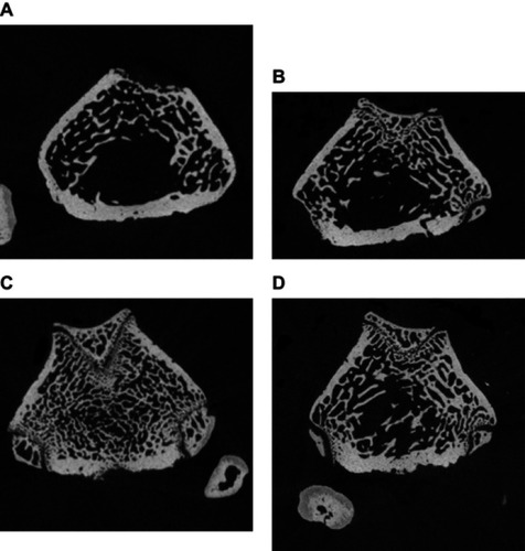 Figure 2 Sagittal sections of distal femur analyzed by high-resolution peripheral quantitative computed tomography compairing control (A) and treated groups of mesenchymal stem cells (B), osteoblasts (C), and exosomes (D).