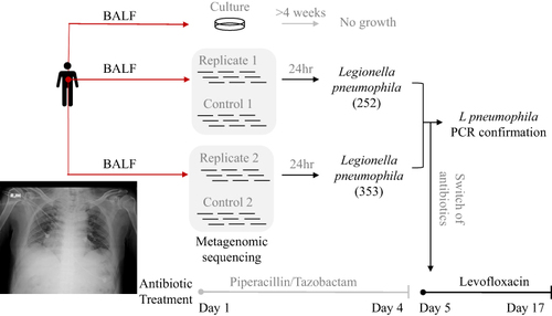 Figure 1 The BALF sample was culture-negative after four weeks. The patient received piperacillin/tazobactam for four days without improvement. The two replicated metagenomic sequencing detected L. pneumophila. The antibiotic was switched to levofloxacin immediately and the Legionella-specific PCR confirmed the existence of L. pneumophila.