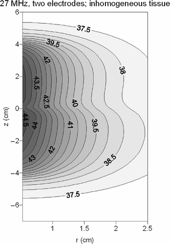 Figure 10. Contour plot of the temperature distribution in inhomogeneous tissue resulting from a 27-MHz current source device with two electrodes, using current amplitudes 1:0.66.