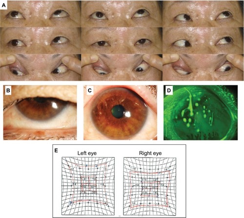 Figure 1 Preoperative findings.