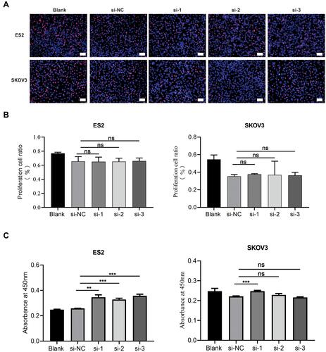 Figure 4 GADD45B knockdown does not inhibit proliferation and viability of EOC cells. (A) EdU assays detected the proliferation ability of ES2 and SKOV3 cells in the NC group and the GADD45B siRNA-downregulated groups. (B) Histograms show the proliferation cell ratio of the EdU assays. (C) CCK-8 assays detected the viability difference of ES2 and SKOV3 cells between the NC group and the GADD45B siRNA-downregulated groups. Experiments were performed at least in triplicate, and the results are shown as the mean ± s.d. Student’s t-test was used to analyse the data (ns, not significant; **p < 0.01; ***p < 0.001). Scale bar, 100 μm.