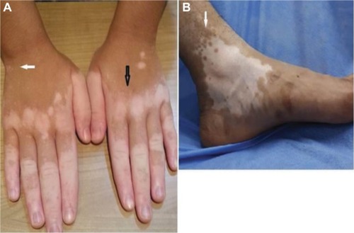 Figure 1 Clinical signs of disease activity.