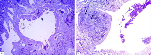 Figure 6.  Histopathological lesions of the secondary bronchi of the lung, at 6 d.p.i. (H & E stain, 100x magnification). 6a: Control group. 6b: Secondary bronchi of an aMPV subtype-B-inoculated broilers showing formation of lymphoid follicles in the submucosa (arrows). Secondary bronchi of an aMPV subtype-A-inoculated broiler show a similar lesion.