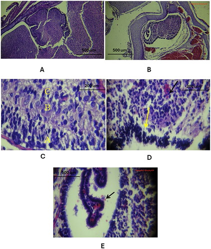 Figure 4. Histological changes of the cellular layers of the cerebellar cortex among the three study groups as compared to the control group (using Eosin and Haematoxylin stain). A: Control group: Normal folia and sulci, proper cerebellum and choroid plexus placement in the skull and 4th ventricle (10X). B: Study group A: Cerebellar atrophy with expanded subarachnoid space, shallow folia and sulci, dilated 4th ventricle, reduced choroid plexus (10X). C: Control group: All three cellular layers visible - A: molecular, B: Purkinje cells, C: granular (40X). D: Study group B: Missing Purkinje cells (yellow arrow), haemorrhage in granular layer (black arrow), apoptotic nuclei in molecular layer (40X). E: Study group C: Ventricular cavity with red blood cells (black arrow), decreased arborisation of choroid plexus villi (40X).