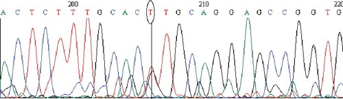 Figure 4. Chromatogram of DNA sequencing for the MT1M (A>C) polymorphism. Heterozygous individual with an A/C genotype. Note: Reverse primer was used. Visualization with BioEdit (v. 7.2.5) software.