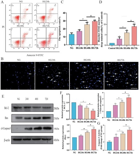 Figure 5. The apoptosis level of pericytes increases in a high-glucose environment. A: FITC-PI flow cytometry representative images; B: Hoechst33342 staining representative images (Hoechest 33342 deep stained cells have been marked with arrows), Scale bar = 50 μm; C: Statistical results of percentage of apoptotic cells by flow cytometry, n = 3, One-way Anova with Turkey's post-hoc test, *P < 0.05, **P < 0.01, ***P < 0.001 vs NG, #P < 0.05 vs HG24 h, &P < 0.05 vs HG48 h; D: Statistical results of Hoechst33342 staining positive cells, n = 3, One-way Anova with Turkey's post-hoc test, *P < 0.05, **P < 0.01,***P < 0.001 vs NG, #P < 0.05 vs HG24 h, &P < 0.05 vs HG48 h; E: Western Blot representative images of Bcl-2, Bax and cl-Caspase3; F: Statistical results of expression levels of Bcl-2, Bax, Cleaved Caspase3 protein, n = 3, One-way Anova with Turkey's post-hoc test, *P < 0.05, **P < 0.01,***P < 0.001 vs NG,# P < 0.05,##P < 0.01 vs HG24 h, &P < 0.05 vs HG48 h; G. Statistical analysis of Caspase 3 activity results in each group of cells, n = 4, One-way Anova with Turkey's post-hoc test, **P < 0.01,***P < 0.001 vs NG,# P < 0.05 vs HG24 h, &P < 0.05 vs HG48 h. Data are presented as the means ± SEMs.