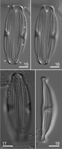 Figs 15–18. Amphora rugosa type material: LM. Figs 15–16. Frustule in ventral view. Same specimen, note the stauroid area in both focuses and the ventral striae in Fig. 15. Arrowheads indicate the conopeum. Fig. 17. Frustule in dorsal view. Note the punctate girdle bands. Fig. 18. General appearance of the valve. Scale bars: 5 µm.