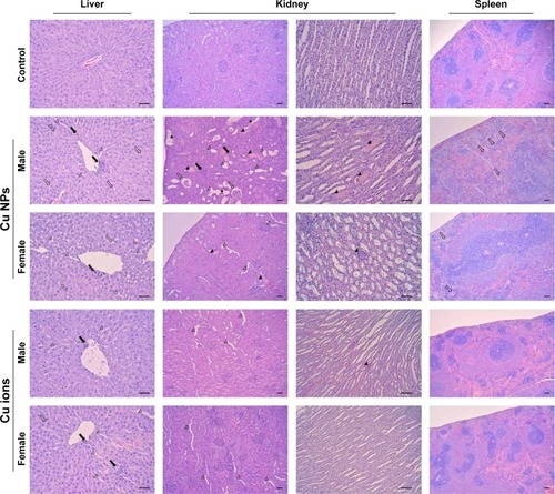 Figure 6 Histopathological results from the liver, kidney, and spleen of rats treated with Cu NPs and Cu ions.Notes: The liver from rats treated with Cu NPs (males for 1,250 mg/kg and females for 2,500 mg/kg) shows mild inflammatory cell infiltration (closed arrows), vacuolation (open arrows), and sinusoid dilation (open arrowheads). The rats treated with Cu ions show similar histopathological alterations at 625 mg/kg in both sexes (×200). The histological changes of kidneys from rats treated with Cu NPs include inflammatory cell infiltration (closed arrows), hyaline cast (closed arrowheads) and cell debris (asterisks) in tubules, dilated tubules (open arrowheads), and atrophy of glomeruli (open arrows). Kidneys treated with Cu ions exhibit mild dilated tubules and cast in tubules (cortex, ×100; medulla, ×200). The spleen of rats treated with Cu NPs shows mild decrease in cellularity in white pulp and increase in multinucleated giant cells (megakaryocytes; open arrows). Spleen of rats treated with Cu ions has no histological changes (×100). Hematoxylin and eosin stain. Scale bar =50 µm. Cu ions, copper(II) chloride.Abbreviation: Cu NPs, copper nanoparticles.