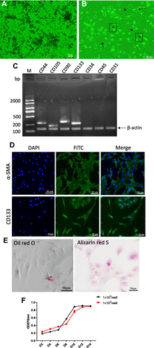 Figure 2 Characterization and differentiation of chicken bone marrow-derived MSCs. (A and B) Morphology of MSCs. The cells exhibit spindle-like morphology during the early growth in DMEM ((A), passage 0, day 3). In later passages, the cells display various morphologies including star-like (arrow), spindle-shaped (arrowhead), and flattened morphology (*) ((B), passage 1, d 2). (C) Reverse transcription (RT)‐ PCR products of surface markers of cells at passage 2. β actin was used as reference gene. Fragments were fractioned on a 1.3% agarose gel and stained with Goldview reagent. Note the lack of CD34, CD45 and CD31 expression. Images are representative of three independent experiments. (D) Representative immunofluorescence staining showing the expression of α-SMA (upper) and CD133 (down) of cells at passage 2. The cell nuclei were labeled with DAPI. Images are representative of three independent experiments. (E) Representative photomicrographs of Oil Red O stain (left) showing intracytoplasmic lipid droplets (red) and of Alizarin Red S stain (right) showing calcium deposits (orange) of cells at passage 2. (F) The “s-shape” cell growth curves show that the chicken bone marrow-derived MSCs exhibit the feature of rapid proliferation. Cell growth reaches logarithmic growth phase even earlier at lower initial density of 1×102 per well compared to 1×103 per well.