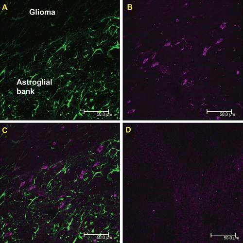 Figure 4.  Double visualization of cells of the peritumoral astroglial bank with the use of MAbE2Сх43 injected in vivo and polyclonal antibodies against GFAP ex vivo. (a) Immunofluorescence of sections obtained using anti-GFAP antibodies (green). (b) Cells intravitally visualized using MAbE2Сх43 conjugated with Alexa Fluor 660 (magenta). (c) Merged images. (d) A negative control (intravenous injection of non-specific immunoglobulins labeled with Alexa Fluor 660). Scale bar, 50 μm.