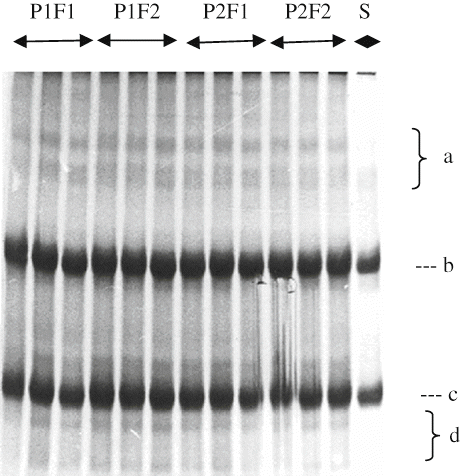 Figure 3 Urea-PAGE profiles of Herby cheeses for 120 days.