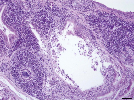 Figure 1. Histological evidence of epididymitis following experimental infection with G. anatis in specific pathogen free cockerels. Infiltration of mononuclear cells in interstitial regions and around the tubules of epididymis, 28 d.p.i., scale bar = 50 µm.