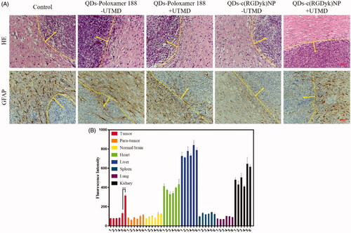 Figure 7. (A) HE and immunohistochemistry staining of C6 glioma sections from rats receiving different QD formulations (brown staining reflects expression of GFAP protein; yellow line: glioma border; yellow arrow: the direction of glioma growth; original magnification: ×200). (B) Fluorescence intensity analysis of glioma tissue and other normal tissues (1 = QDs – UTMD; 2 = QDs + UTMD; 3 = QDs-poloxamer 188 – UTMD; 4 = QDs-poloxamer 188 + UTMD; 5 = QDs-c(RGDyk)NP – UTMD; 6 = QDs-c(RGDyk)NP + UTMD; **p < .01, n = 3).
