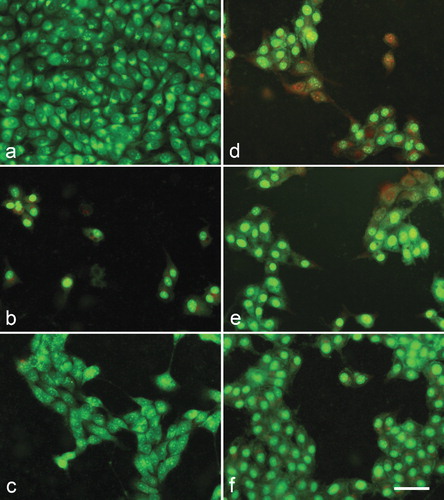 Figure 3. A complete monolayer of 8MGBA human glioblastoma multiforme cells with bright yellow-green nucleoli and bright yellow-green granular accumulations within the cytoplasm – culture medium control (a); 8MGBA cells 72 h following the treatment with с 500 µg/mL meloxicam (b); 500 µg/mL Cu-Meloxicam (c); 500 µg/mL Zn-meloxicam (d); 500 µg/mL Co-meloxicam (e) and 500 µg/mL Ni-Meloxicam (f). Note: Significant cell losses as well as cell shrinkage with foamy vacuolation of the cytoplasm (b). Moderate cell losses (c, d and e) as well as chromatin condensation (d, e). Acridine orange – propidium iodide staining. Bar = 50 µm.